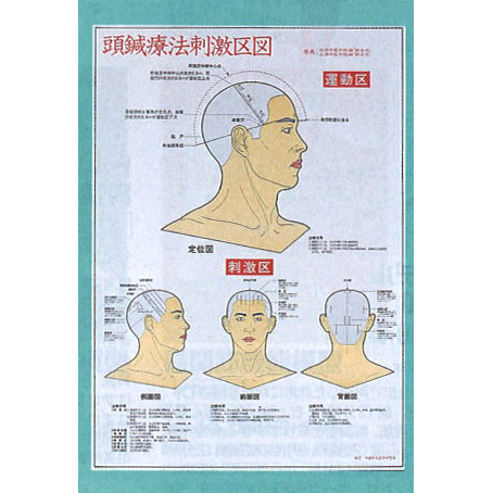 頭鍼療法刺激区図　