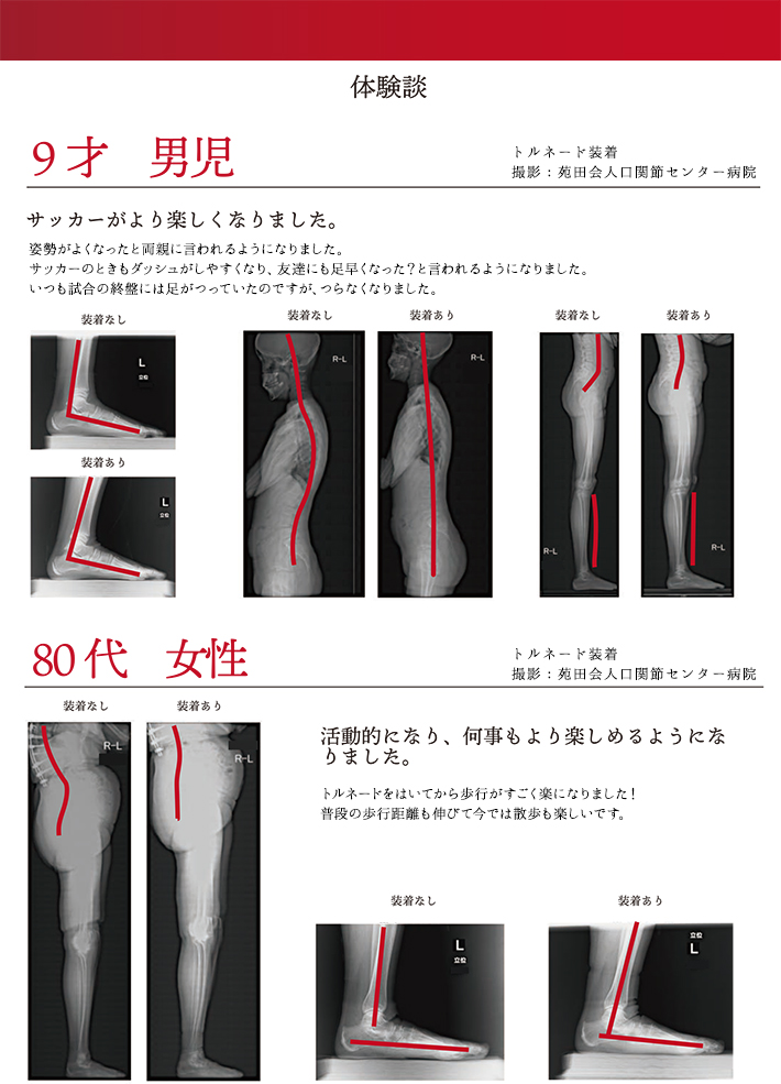 重心ソックス 体験談