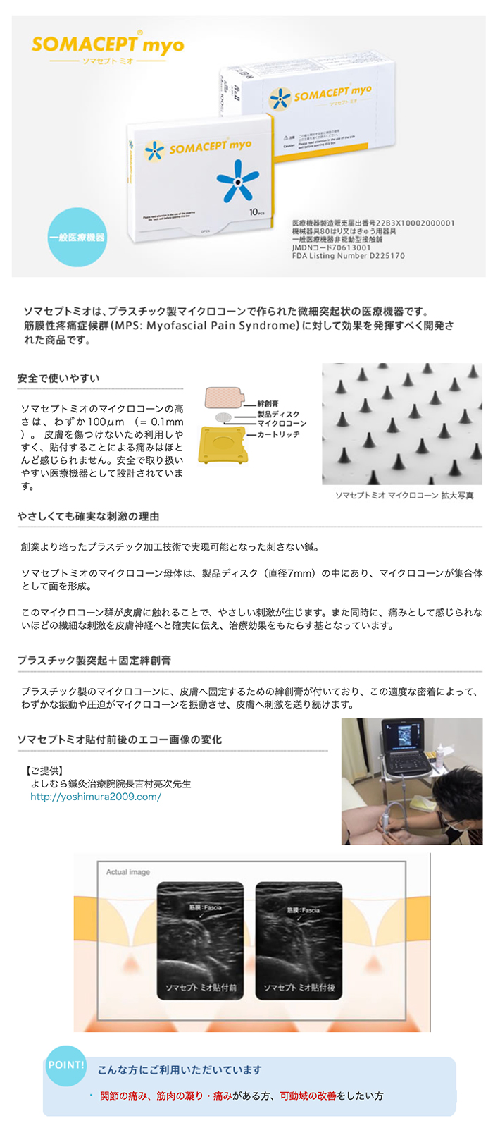 ソマセプト プラスチック製マイクロコーンで作られた医療機器